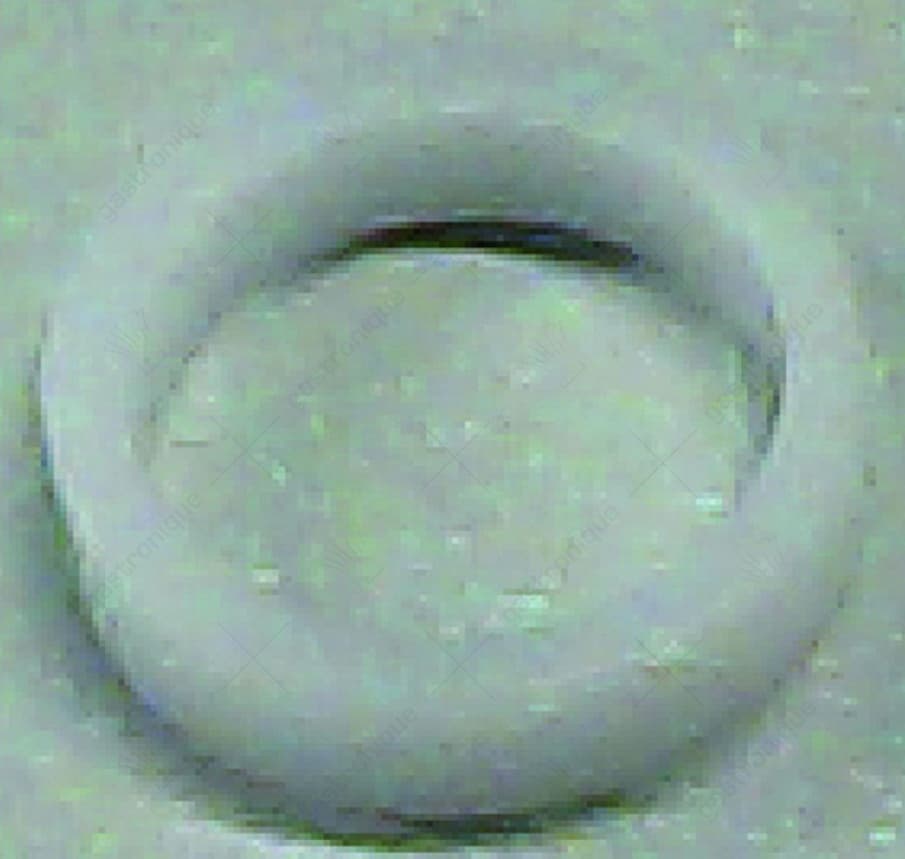 shoulder ring